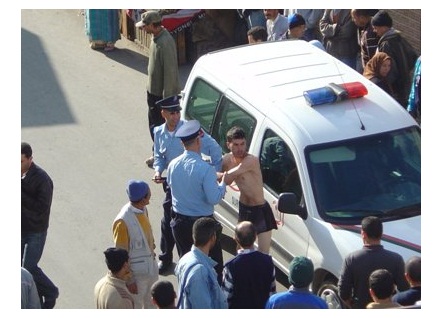 إصابة فتاة بجروح غائرة في خدها، بعد تعرضها من قبل مجرمين للسرقة الموصوفة، بواسطة السلاح الأبيض