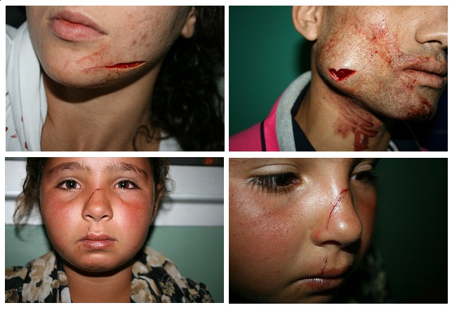 بالصور.. مجرم يعتدي بسيف على 4 أشخاص بشارع الزرقطوني بالجديدة لاجل تشويه صورتهم