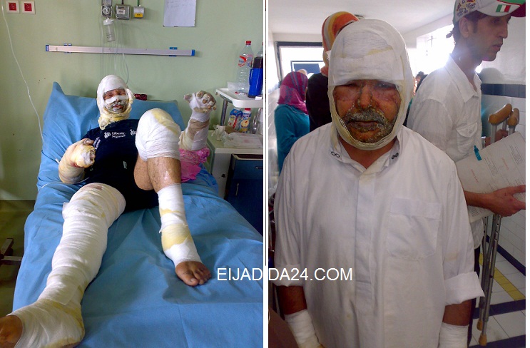 نجاة شخصين من الموت بعد انفجار قنينة غاز بمطعم بحي لالة زهرة بالجديدة