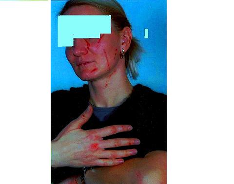 سيدة أجنبية تتعرض لاعتداء شنيع بسيدي بنور