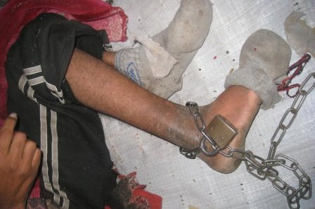 الحسيمة:أسرة تحتجز إبنها المختل عقليا 10 سنوات