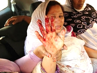 بالصور : حقيقة صورة المرأة الصحراوية التي تدعي إصابتها بجروح إثر تدخل مصالح الأمن بالعيون