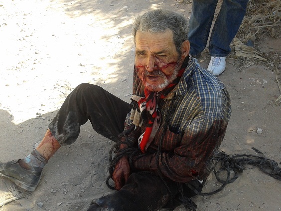 العثور على رجل خمسيني مكبل اليدين ملقى بجانب فرن قرب مقبرة ازمور