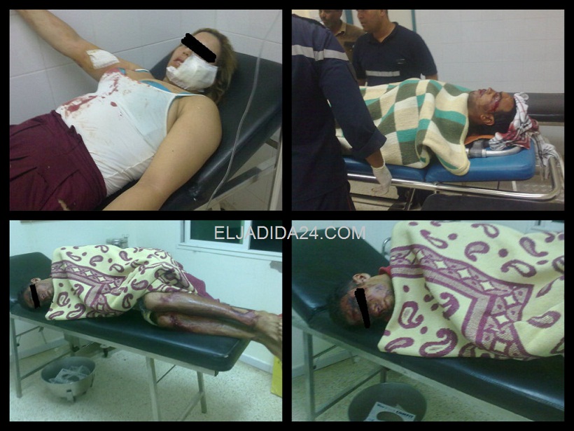 ازمور : وفاة زائر في الشارع العام واصابة عدة اشخاص في حوادث متفرقة