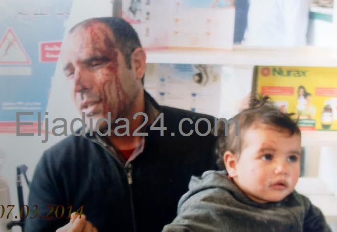 صيدلاني يتعرض الى اعتداء شنيع داخل صيدليته بجماعة سانية بركيك بإقليم سيدي بنور