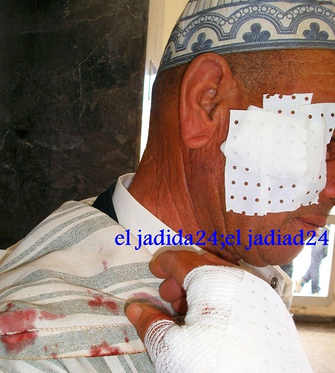 خبر طريف: قط مسعور يهاجم مواطن بالمستشفى الإقليمي بسيدي بنور