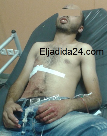 ادخال شاب الى قسم الانعاش بمستشفى الجديدة بعد تعرضه الى اعتداء شنيع من طرف مجهولين داخل حديقة عمومية