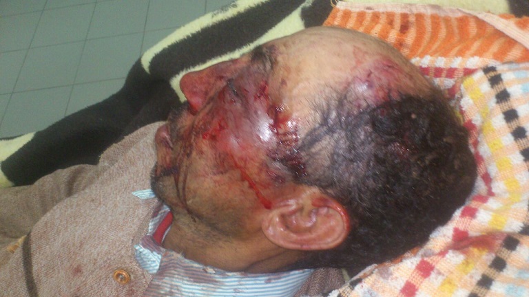 احالة 3 شبان على جنايات الجديدة بعد اعتداء شنيع على رجل مسن من أجل السرقة