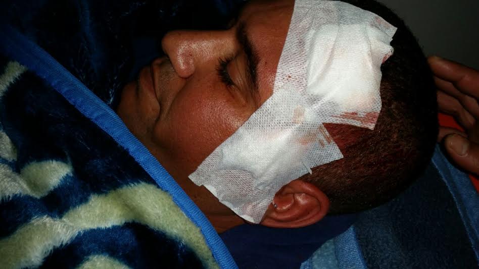 كبار مسؤولي الأمن الإقليمي بالجديدة يتابعون عن كثب الحالة الصحية للشرطي ضحية حادثة السير