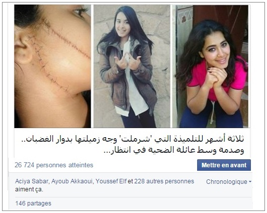نشطاء 'الفايسبوك' غاضبون من الحكم 3 أشهر في حق المعتدية بشفرة حلاقة على الطفلة نسيمة