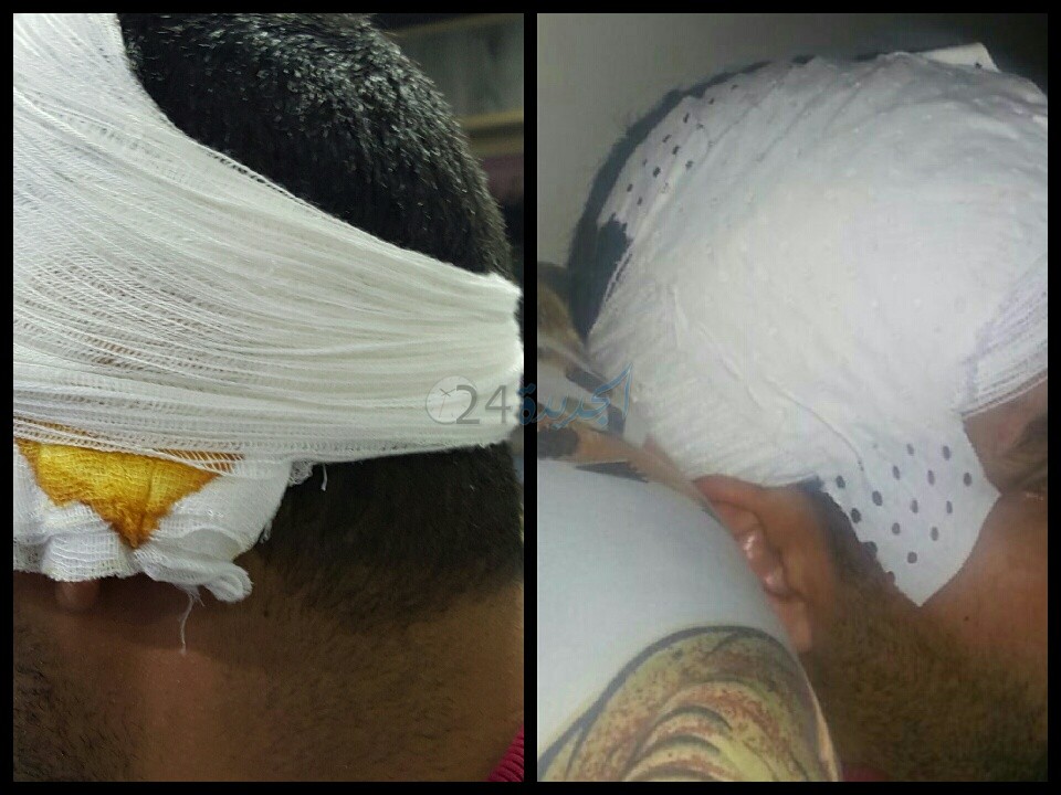 اعتداء على مسؤول بشركة لتوزيع الغاز بالجديدة من طرف عصابة قرب الحي الصناعي