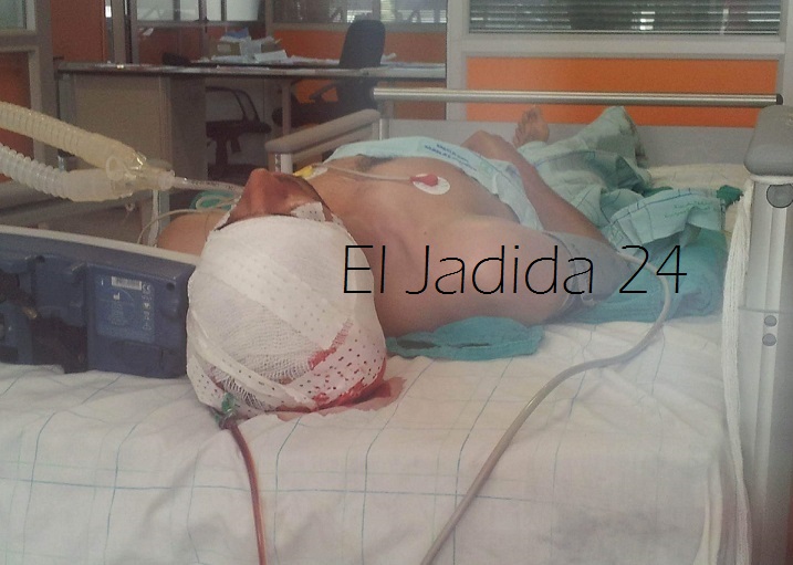 وفاة غامضة في مدينة الجديدة.. حادثة سير أم جريمة قتل ''مقنعة'' ؟!