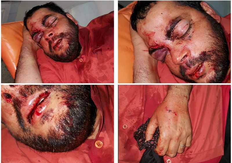 تعرض مواطن الى اعتداء شنيع بمركز مولاي عبد الله