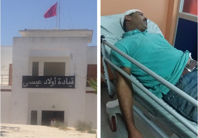 اصابة 20 مناضلا من حزب العدالة والتنمية بجروح في اعتداء همجي بجماعة اولاد عيسى