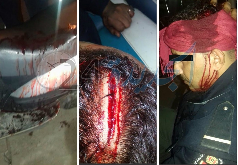 بالصور.. موظف بالسجن المحلي يتعرض الى محاولة قتل فاشلة بالشارع العام بالجديدة