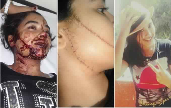 احالة ملف التلميذة ضحية الاعتداء بشفرة حلاقة على غرفة الجنايات بالجديدة بعد ظهور معطيات جديدة