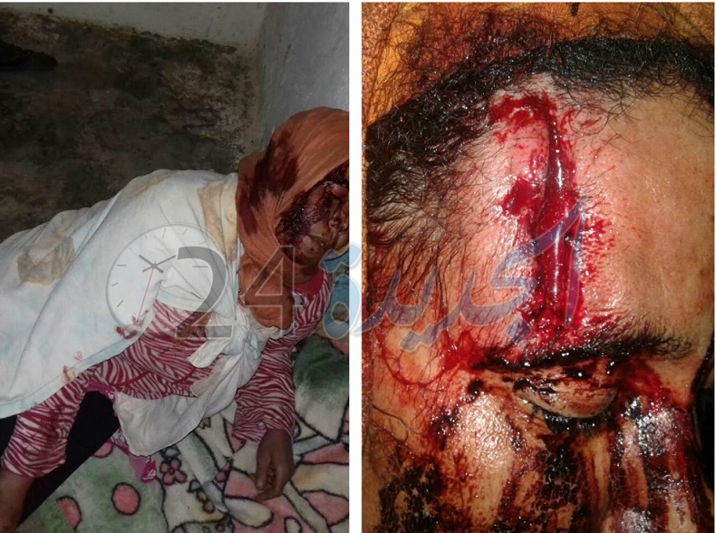 صراع بين عائلتين بتراب جماعة متوح ينتهي داخل قسم المستعجلات بمستشفى الجديدة