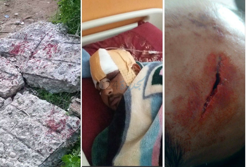 سلطات آزمور تتنكر لضحية سور المدينة العتيقة بعدما رمت به داخل المستشفى في وضعية جد حرجة