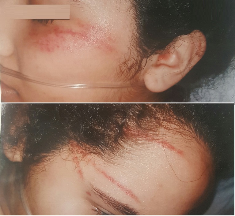 طالبة بمعهد عالي للهندسة بالجديدة تتهم زميلة لها بتعنيفها في الشارع العام