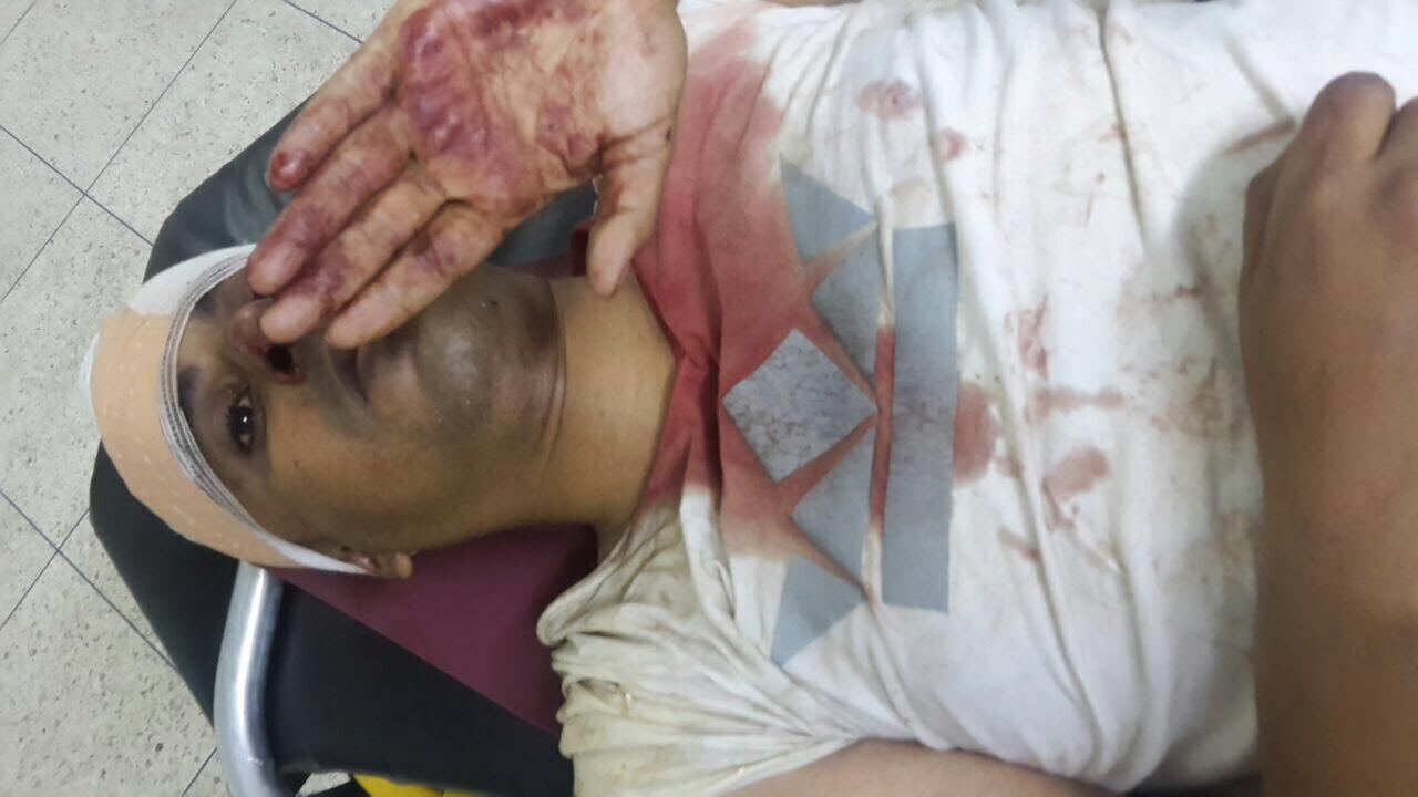 بالصور.. ''حراك الحسيمة'' يرسل 23 عنصرا من القوات العمومية إلى المستشفى