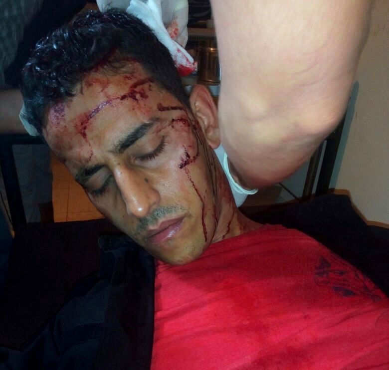 بالصور..  ''سلمية''  حراك الريف تحصد مزيدا من الضحايا في قوات حفظ الأمن والنظام العام