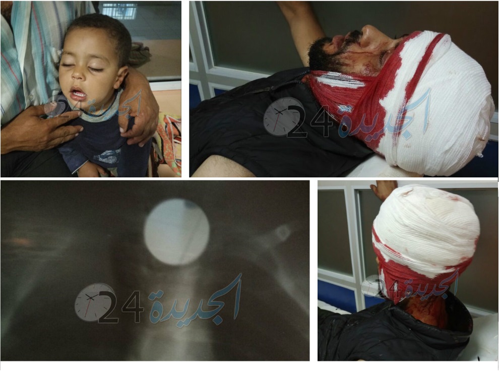 الموت يحلق فوق مستشفى محمد الخامس بالجديدة بدل مروحية الوردي