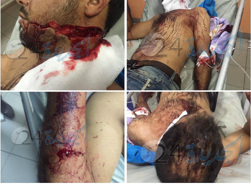 بالصور.. مجرم خطير يخلق الرعب في الجديدة ويرسل 3 ابرياء الى المستشفى