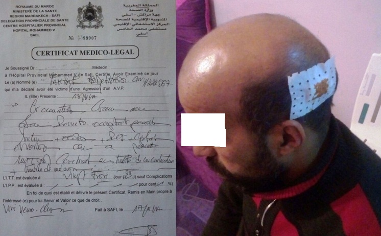 الاعتداء على أستاذ بالزمامرة يثير سخط الاسرة التعليمية بالاقليم