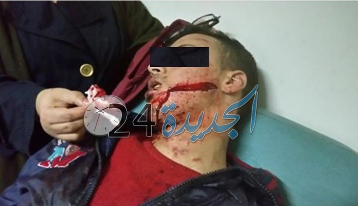 خطير.. توقيف فتاة قاصر بآزمور بعد ان 'شرملت' رجلا بواسطة شفرة حلاقة