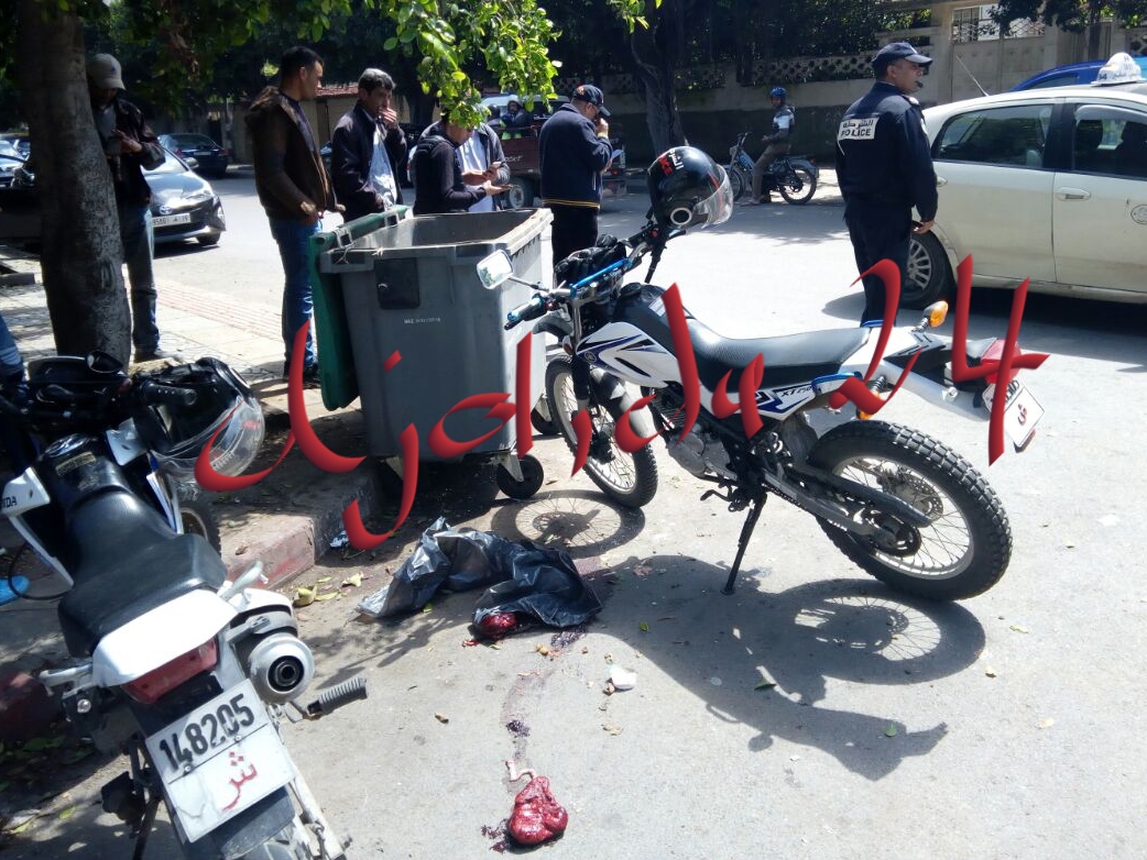 عاجل.. أعضاء بشرية في ''بركاسة الأزبال'' تستنفر أمن الجديدة