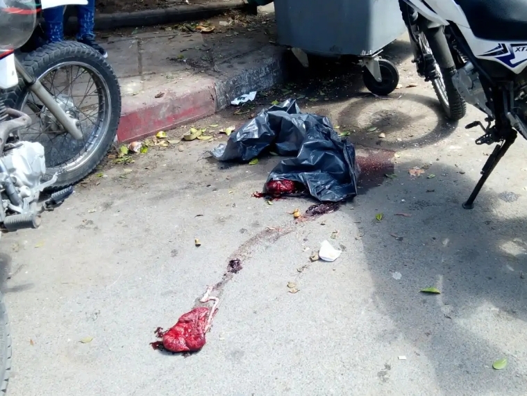 هذه حقيقة  ''البقايا البشرية'' التي استنفرت الشرطة القضائية بأمن الجديدة