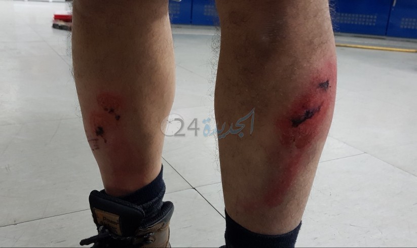 شاهد بالصورة.. الكلاب الضالة تهاجم مواطنا أعزلا قرب إقامات البستان بالجديدة