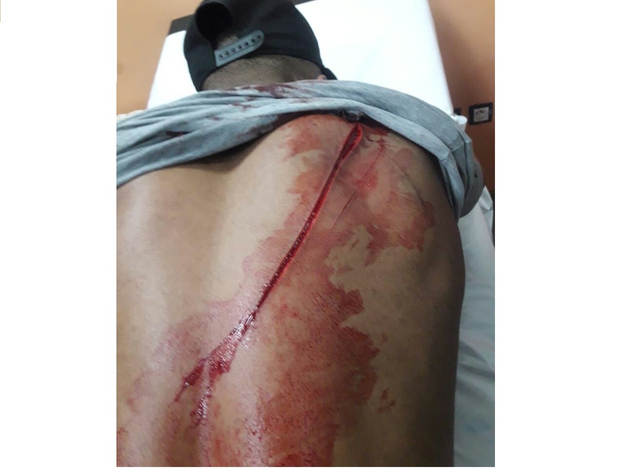 شجار بين شابين بالسيوف في وسط الجديدة  كاد أن يتسبب في جريمة قتل