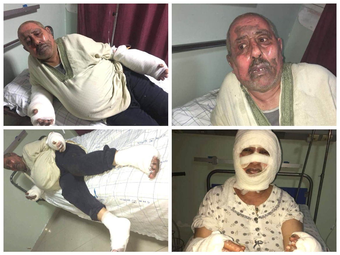 الإهمال يقتل الفنان مصطفى الجلبي.. بعد أن التهمته وزوجته النيران بالجديدة