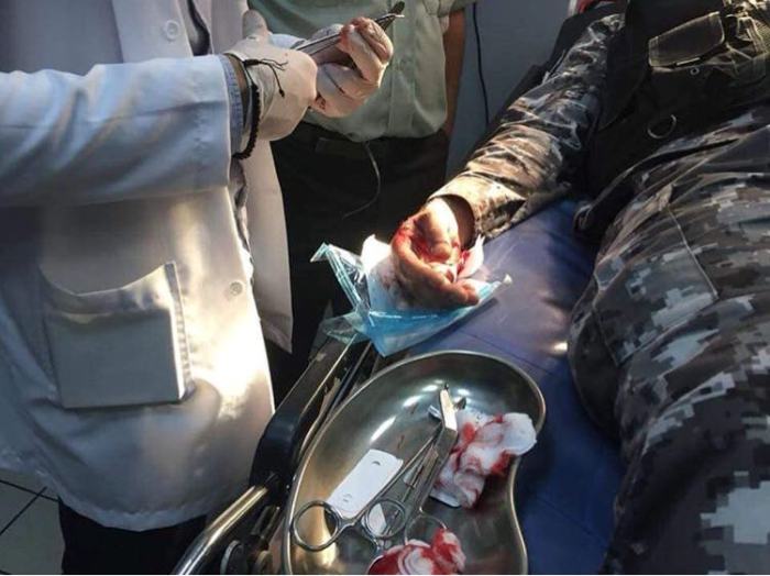''بزناز'' يعتدي ب''جنوي'' على عنصر من الدرك الملكي بمركز سيدي إسماعيل