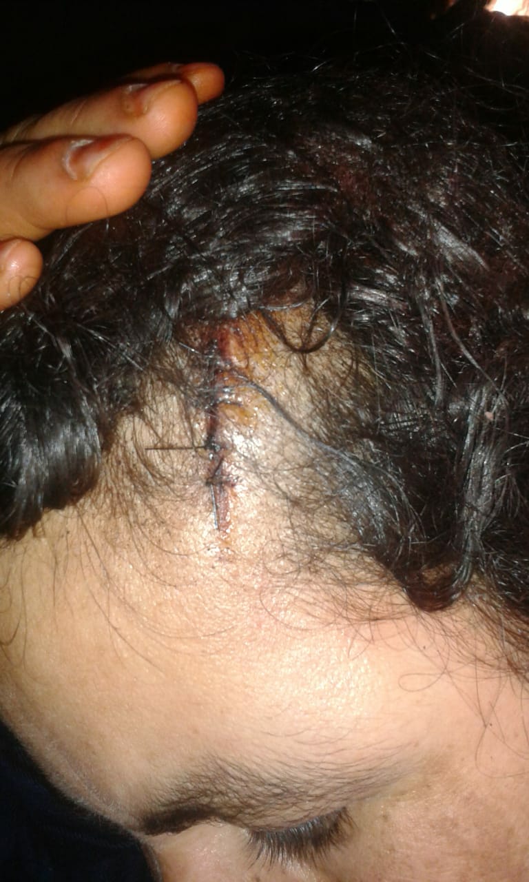 سيدة من اولاد فرج  تتعرض لتعنيف خطير كاد ان ينهي حياتها عشية المصادقة على قانون مناهضة العنف ضد النساء