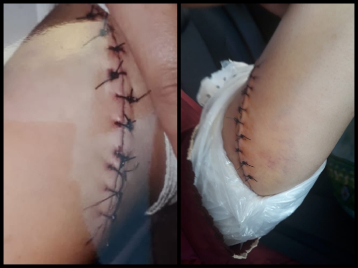 فتح تحقيق مع عون سلطة بتهمة الاعتداء على سيدة بالسلاح الأبيض قرب الحي الصناعي بالجديدة