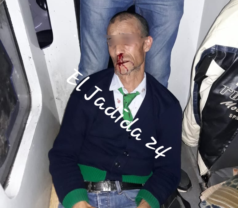 استنفار أمني كبير بدوار الغربة بعد تعرض سائق حافلة للنقل الحضري إلى اعتداء شنيع من طرف أحد المجرمين