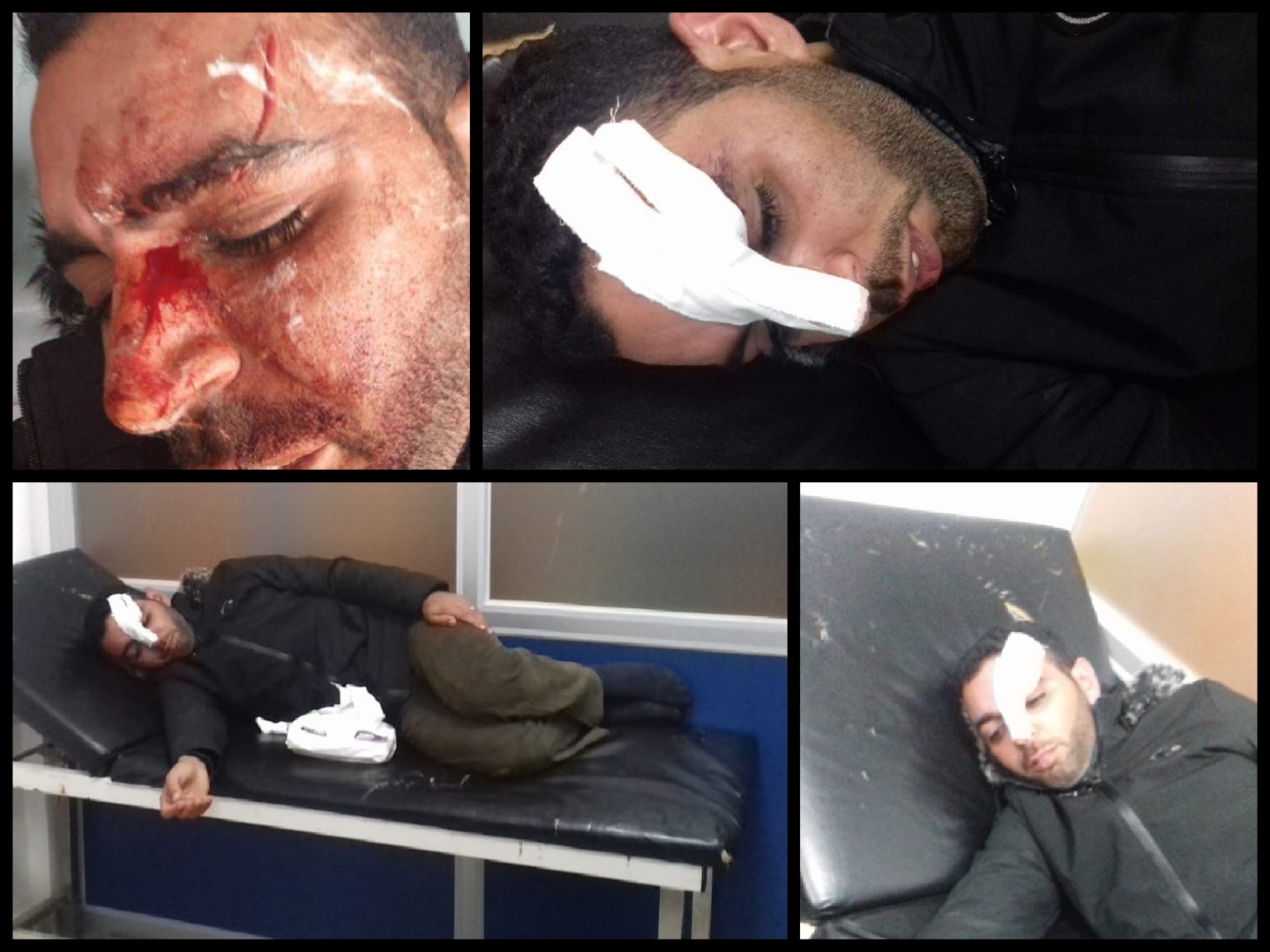 اعتداء شنيع على استاذ في الشارع العام بجماعة خميس متوح بإقليم الجديدة