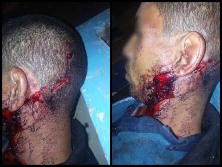 شاهد.. شاب يتعرض الى اعتداء اجرامي ومحاولة القتل بتراب جماعة اولاد عيسى