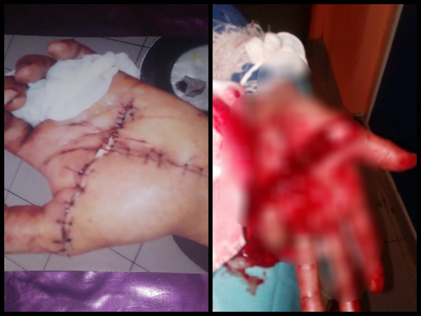 مواطن من الجديدة يستنجد بالوكيل العام بعد تعرّضه لمحاولة قُتل بواسطة السلاح الأبيض