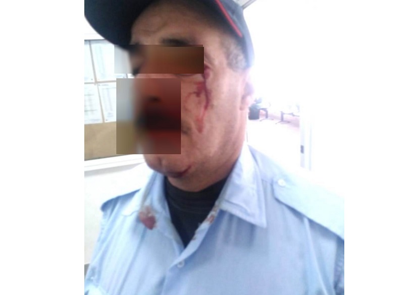 مواطن معتدى عليه يشكو  للحموشي ضابط شرطة بأمن الجديدة