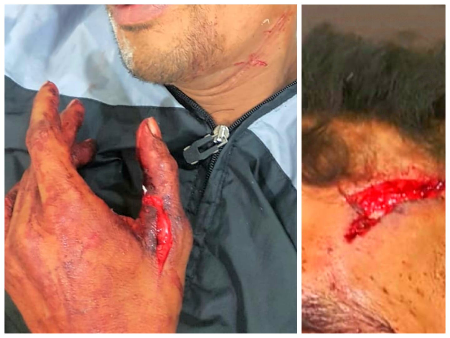 مجرم خطير تحت تأثير ''القرقوبي'' يعتدي بالسلاح الأبيض بسيدي بنور.. والشرطة ترد بطلقات  تحذيرية