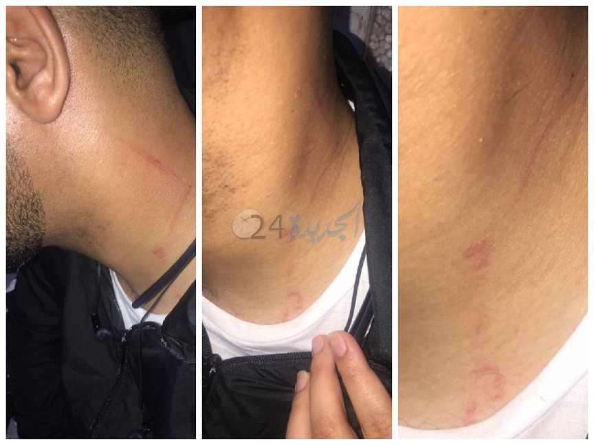 مواطن يتهم أمن الجديدة بتعنيفه واعتقاله بشكل تعسفي بعد مساعدته لدورية أمنية في اعتقال مجرم في الشارع العام