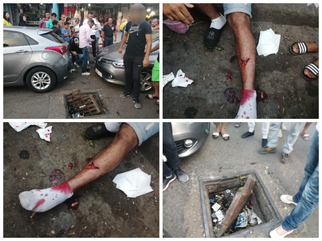 بالصور.. بالوعة بشارع محمد الخامس بالجديدة تتسبب في كسر مزدوج برجل مواطن