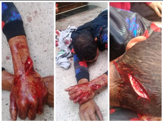 صادم .. شاب يشرمل أحد جيرانه بسيف ويرسله الى قسم الانعاش بمستشفى الجديدة