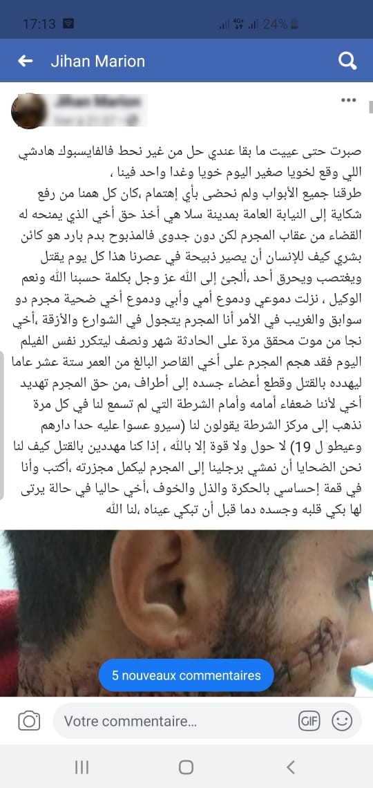 المديرية العامة تكشف ل'الجديدة24' ملابسات إيقاف مشتبه في اعتدائه على قاصر بسلا