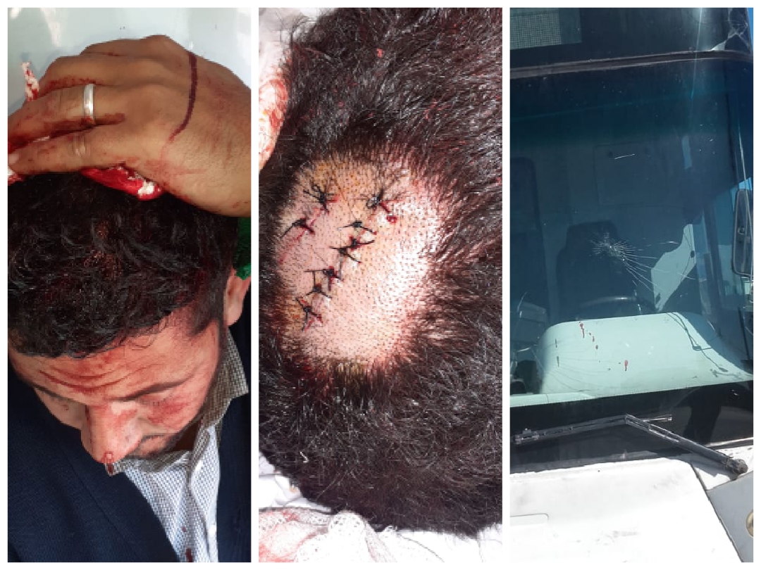 سائق حافلة للنقل الحضري بالجديدة يتعرض لاعتداء شنيع وجدل حول الاختصاص الترابي بين مصالح الأمن والدرك يؤجل الاستماع للضحية