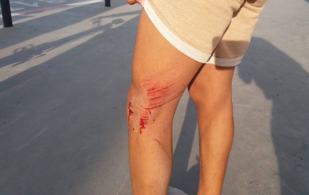 لصوص يعتدون على شاب قرب الحي البرتغالي بالجديدة بدافع السرقة ويلوذون بالفرار