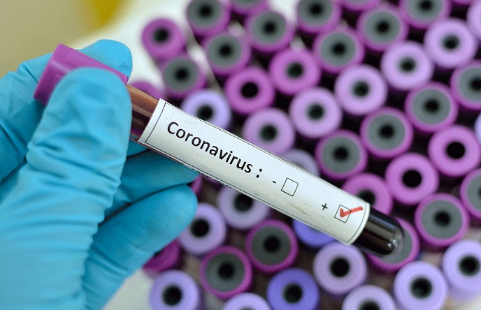 عاجل.. الكشف عن نتائج المخالطين ال17 للسيدة التي اصيبت بفيروس كورونا بجماعة اثنين شتوكة